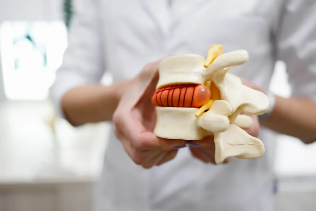 Chiropractic treatment for lower back pain in Oxford