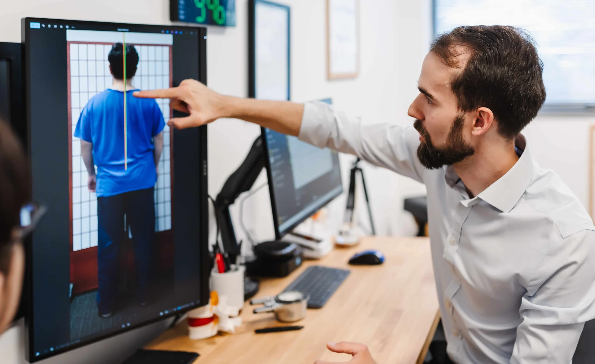 Posture structural analysis
